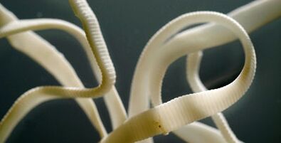 plokščias parazitas iš žmogaus kūno