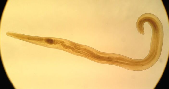 Pinworms yra dažnas apvalių parazitų tipas, sukeliantis enterobiozę.